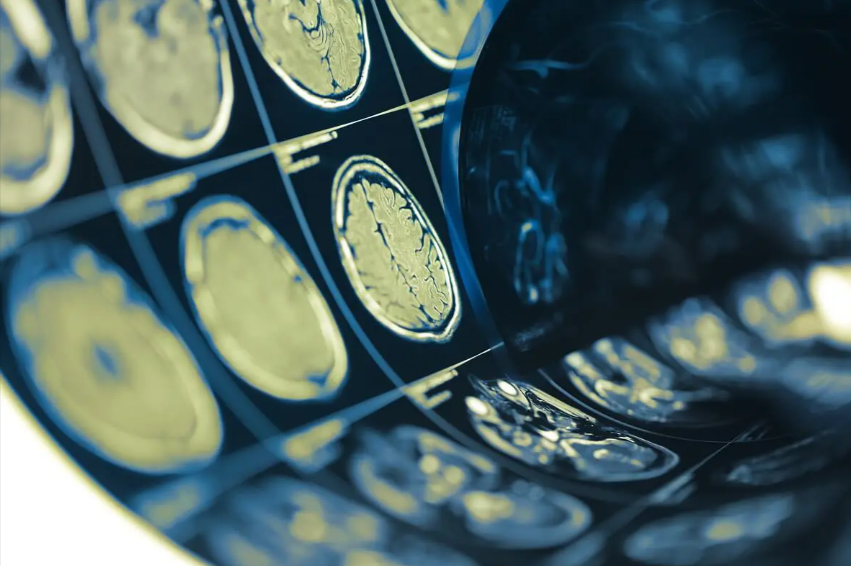 5 things businesses can learn from concussion protocols